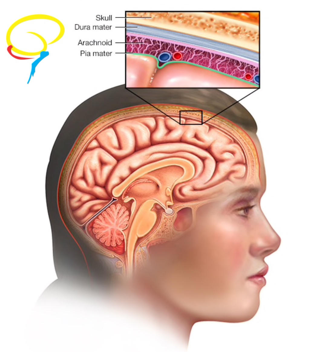 Figura 2: Meninges cerebrais, demonstrando a camada subaracnóide, de onde originam-se os meningiomas.